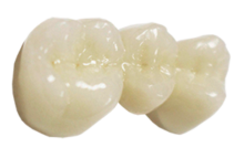 Zirconia, dental crown, tooth crown
