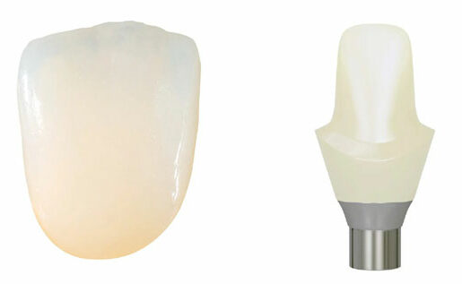 all ceramic, full ceramic, dental crown, crowns and bridges