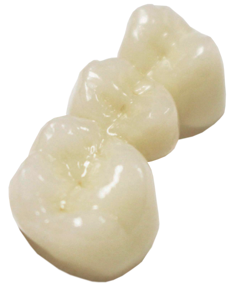 OEZ, Layered zirconia, dental crown, tooth crown, dental bridge