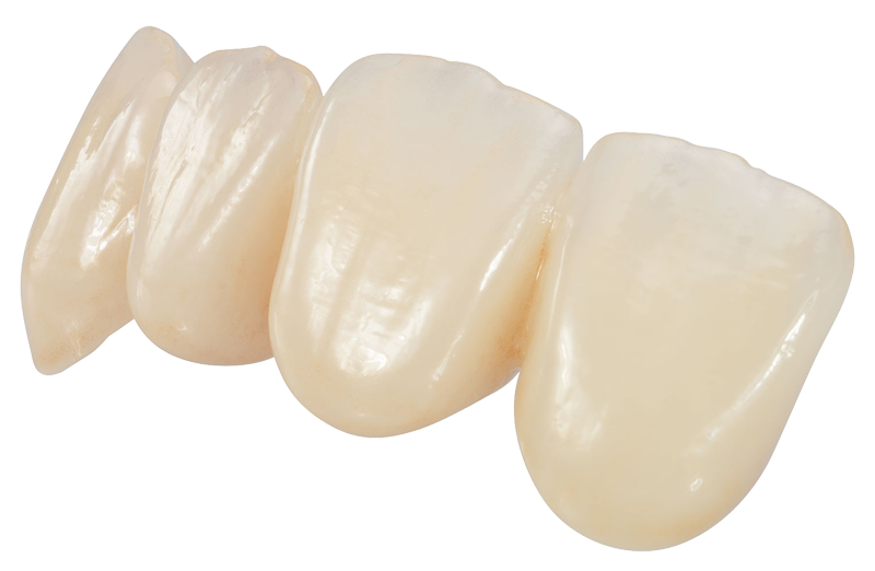 Polychromatic, OZ Signature, dental crown, dental bridge