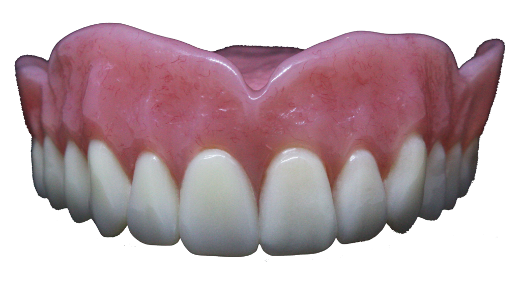 Premium dentures, affordable dentures & implants, Full Dentures, Full Mouth Denture Implants, Ottawa Dental Laboratory