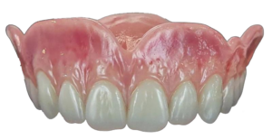 affordable dentures & implants, Full Dentures, Full Mouth Denture Implants, Ottawa Dental Laboratory