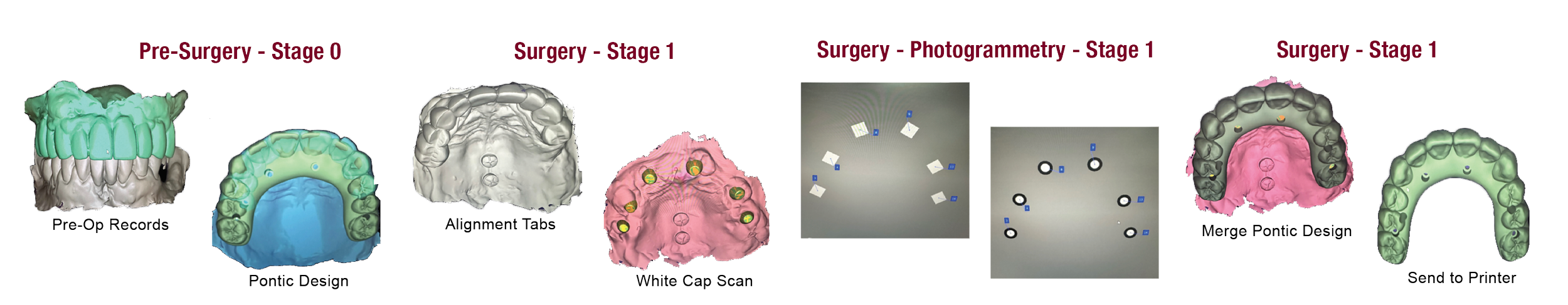 photogrammetry, digital, 3D Data, implant placement, icam