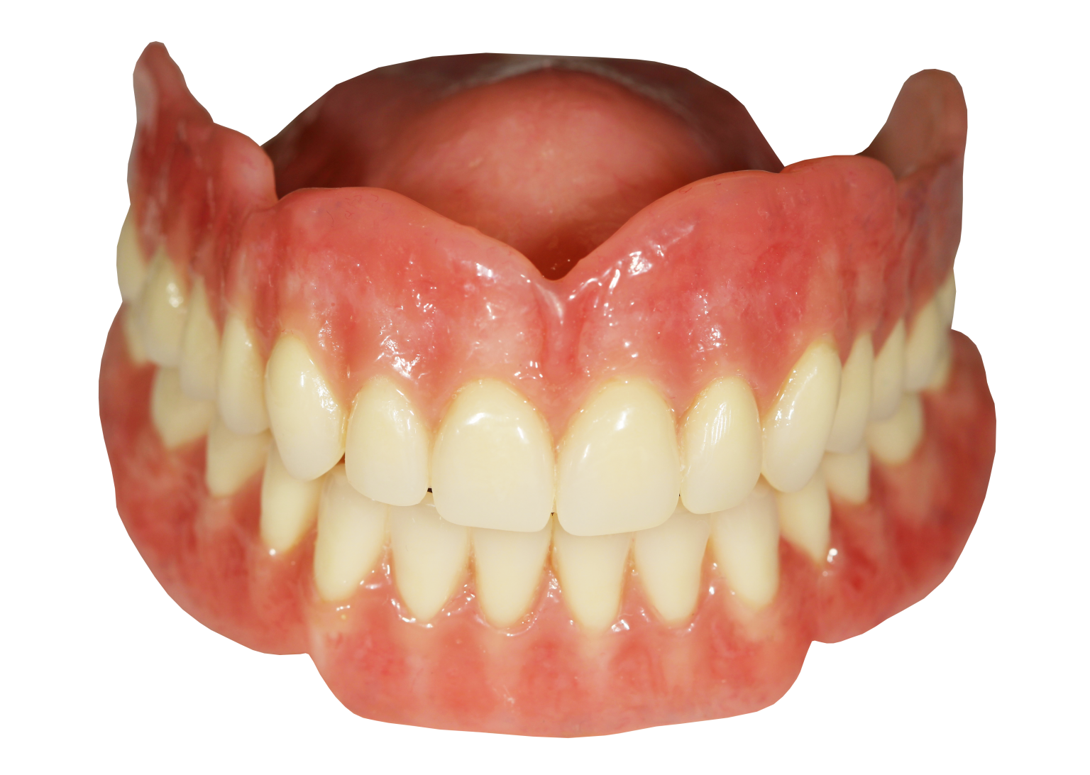 Full Dentures with the Ottawa Dental Laboratory LLC