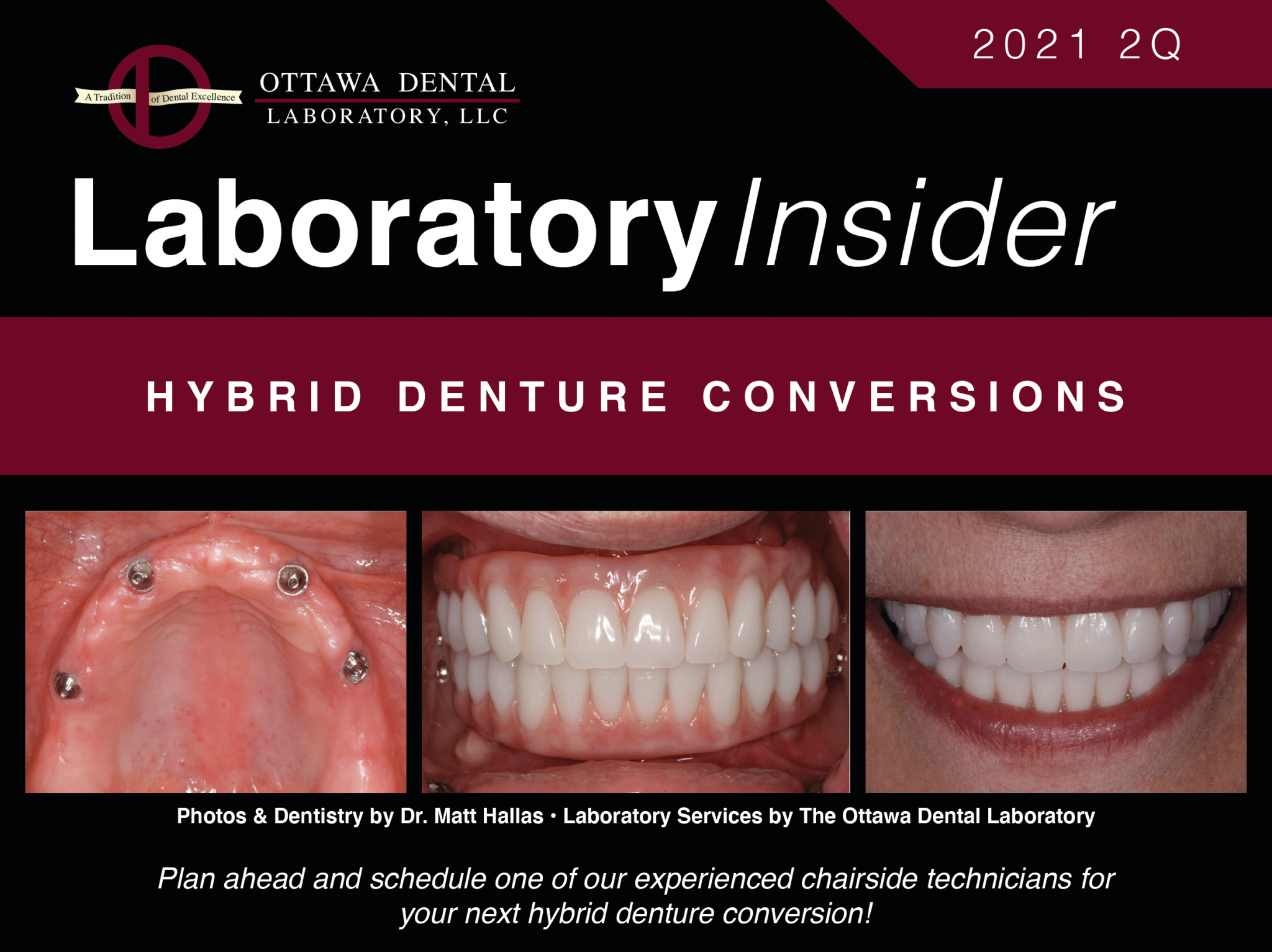 Laboratory Insider Ottawa Dental Laboratory LLC